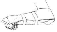 A[